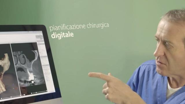 La pianificazione chirurgica digitale